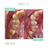 Dentme Aesthetic Dental Clinic