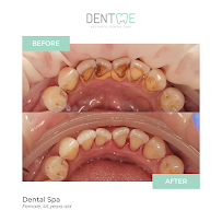 Dentme Aesthetic Dental Clinic