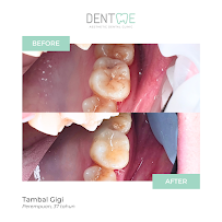 Dentme Aesthetic Dental Clinic
