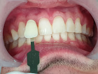 Dentme Aesthetic Dental Clinic