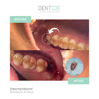Dentme Aesthetic Dental Clinic