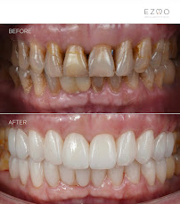 Ezmo Dental Aesthetic Clinic - WEST