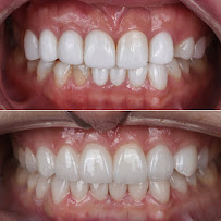 Ezmo Dental Aesthetic Clinic - WEST
