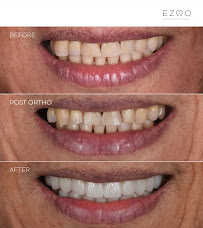 Ezmo Dental Aesthetic Clinic - WEST