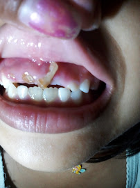 Klinik Gigi Surabaya - SCHATZ Dental Aesthetic Clinic
