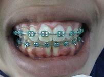 Klinik Gigi Surabaya - SCHATZ Dental Aesthetic Clinic