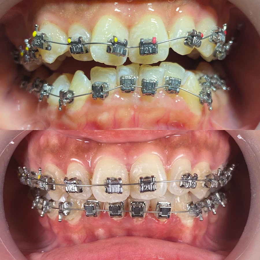 Absolute Dental Implant and Aesthetic Center - dental clinic in Surabaya, Indonesia