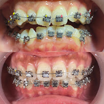 Absolute Dental Implant and Aesthetic Center in Surabaya
