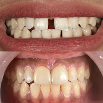 Absolute - Dental Implant and Aesthetic Center