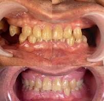 Absolute - Dental Implant and Aesthetic Center