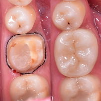 AVA Dental Aesthetic | DOKTER GIGI BANDUNG