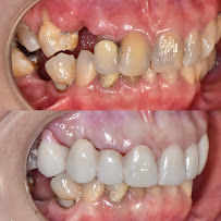 AVA Dental Aesthetic | DOKTER GIGI BANDUNG