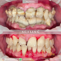 AVA Dental Aesthetic | DOKTER GIGI BANDUNG