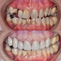 AVA Dental Aesthetic | DOKTER GIGI BANDUNG