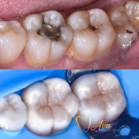 AVA Dental Aesthetic | DOKTER GIGI BANDUNG