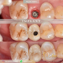 AVA Dental Aesthetic | DOKTER GIGI BANDUNG