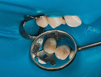 Infinite Dental Care