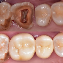 Ava Dental Aesthetic Surya Sumantri | Dokter Gigi Bandung