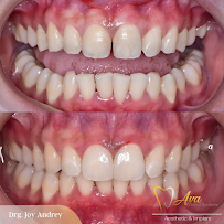 Ava Dental Aesthetic Surya Sumantri | Dokter Gigi Bandung