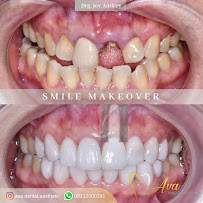 Ava Dental Aesthetic Surya Sumantri | Dokter Gigi Bandung
