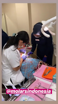 Molars Dental Aesthetics