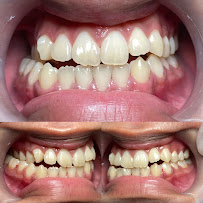 Dokter Gigi Bandung - EDental