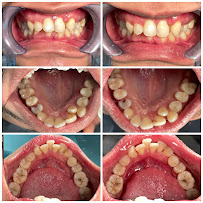 Dokter Gigi Bandung - EDental