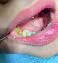 Dokter Gigi Bandung - EDental
