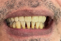 Dokter Gigi Bandung - EDental