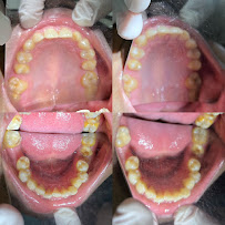 Dokter Gigi Bandung - EDental