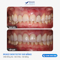 Peace Dentistry Da Nang