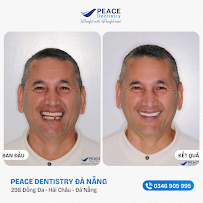 Peace Dentistry Da Nang
