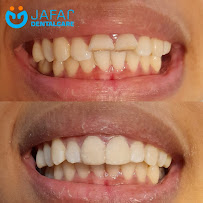 JAFAR DENTAL CARE