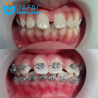JAFAR DENTAL CARE