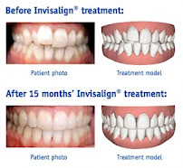Medan Dental Specialist Center