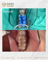 Sheen Dental Care