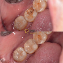 Sheen Dental Care