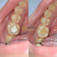 Sheen Dental Care