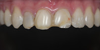 Jade Dental Expert (drg Darius P Ongko,Sp. Perio & drg Christinawaty Sutan Sp.Ort) Praktek Dokter Gigi Spesialis Medan