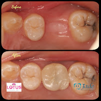 Jade Dental Expert (drg Darius P Ongko,Sp. Perio & drg Christinawaty Sutan Sp.Ort) Praktek Dokter Gigi Spesialis Medan