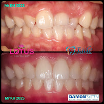 Jade Dental Expert (drg Darius P Ongko,Sp. Perio & drg Christinawaty Sutan Sp.Ort) Praktek Dokter Gigi Spesialis Medan