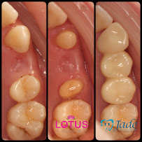 Jade Dental Expert (drg Darius P Ongko,Sp. Perio & drg Christinawaty Sutan Sp.Ort) Praktek Dokter Gigi Spesialis Medan