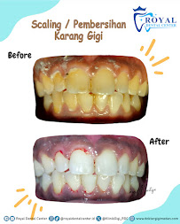Royal Dental Centre