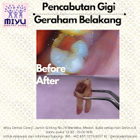 Miyu Dental Care