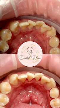 Dental Place Cemara Asri / PRAKTEK DOKTER GIGI ANGEL