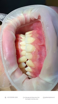 Dental Place Cemara Asri / PRAKTEK DOKTER GIGI ANGEL