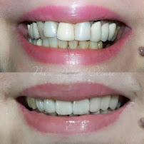 Nila Dental Clinic