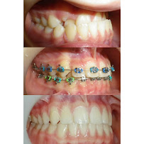 Nila Dental Clinic