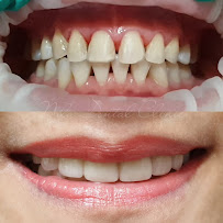 Nila Dental Clinic in Medan