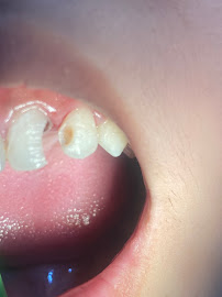 Hanara Dental Clinic (Klinik Gigi drg.Ernawati Lubis)